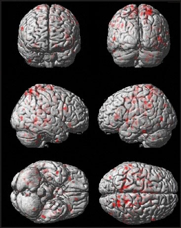 6 images of brain